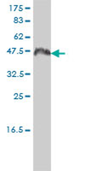 CCNK monoclonal antibody (M01), clone 3B7-1B9