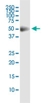 CDS2 monoclonal antibody (M01), clone 2B9