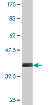 ADAM20 monoclonal antibody (M05), clone 4B10