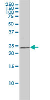 CRADD monoclonal antibody (M01), clone 1F8