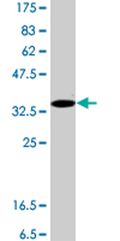 HYAL2 polyclonal antibody (A01)