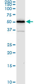 ALDH4A1 monoclonal antibody (M01), clone 1A12-A5