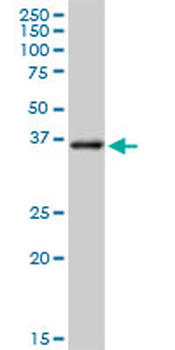 AKR1C3 purified MaxPab rabbit polyclonal antibody (D01P)