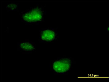 SSNA1 purified MaxPab mouse polyclonal antibody (B01P)