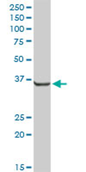 AKR7A2 MaxPab rabbit polyclonal antibody (D01)