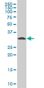 PDXK polyclonal antibody (A01)