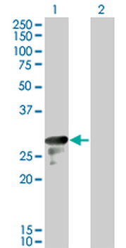 DENR monoclonal antibody (M01), clone 1H3
