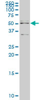 API5 monoclonal antibody (M01), clone 1C2