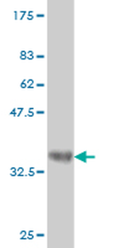 ENC1 monoclonal antibody (M02), clone 3B1