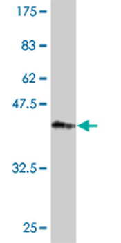 PKP4 monoclonal antibody (M01), clone 1B2