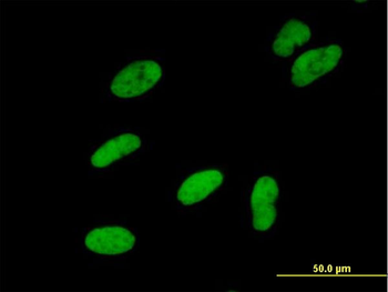 SMARCA5 MaxPab mouse polyclonal antibody (B01)