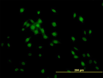 KLF11 monoclonal antibody (M03), clone 10D8