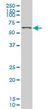 KLF11 monoclonal antibody (M02), clone 10C5