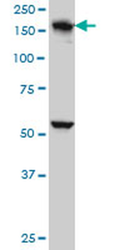 EEA1 monoclonal antibody (M02A), clone 1D4