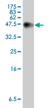 USP9X polyclonal antibody (A01)