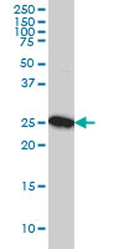 CLPP monoclonal antibody (M01), clone 3E2