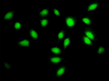 SF3A2 monoclonal antibody (M01), clone 3B6