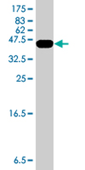 HMGA2 polyclonal antibody (A01)
