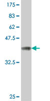 MFAP5 polyclonal antibody (A01)