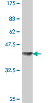 NUP214 polyclonal antibody (A01)