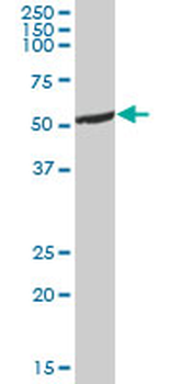 ALDH5A1 purified MaxPab mouse polyclonal antibody (B01P)