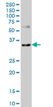 CXCR4 monoclonal antibody (M04), clone 2G9