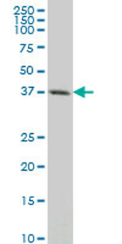 CXCR4 monoclonal antibody (M02), clone 1F8