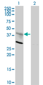 CXCR4 monoclonal antibody (M01), clone 2H5