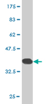 ZNF133 monoclonal antibody (M01), clone 1C6