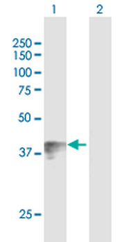 WNT7B purified MaxPab mouse polyclonal antibody (B01P)
