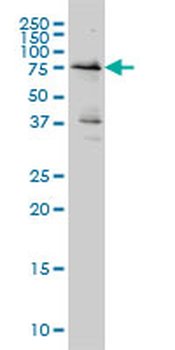 WEE1 monoclonal antibody (M01A), clone 5B6