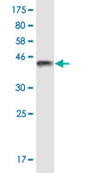TRPV1 monoclonal antibody (M02), clone 1A8