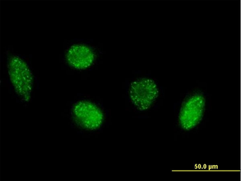 VIM purified MaxPab mouse polyclonal antibody (B01P)