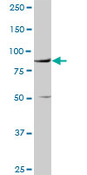 VCAM1 purified MaxPab rabbit polyclonal antibody (D01P)