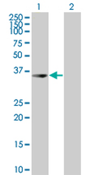 UROD MaxPab mouse polyclonal antibody (B02)