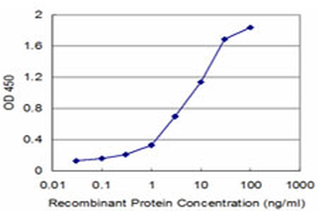 UMPS monoclonal antibody (M06), clone 2B10