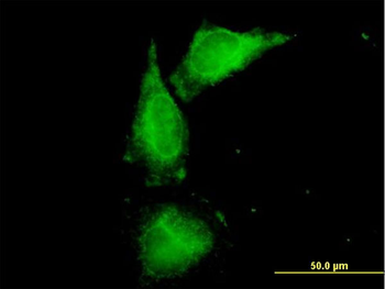 UMOD purified MaxPab mouse polyclonal antibody (B01P)