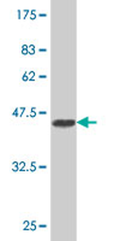 UGT8 polyclonal antibody (A01)