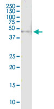 TYR MaxPab rabbit polyclonal antibody (D01)