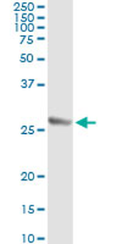TWIST1 monoclonal antibody (M01), clone 3E11