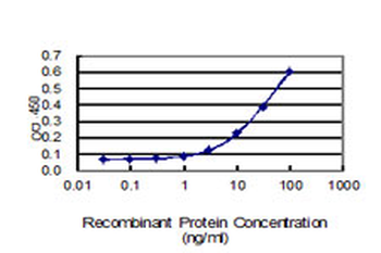 TUBB2A monoclonal antibody (M03), clone 2B2