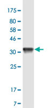 TTPA monoclonal antibody (M01A), clone 7B5