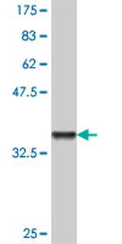 TRIP6 polyclonal antibody (A01)