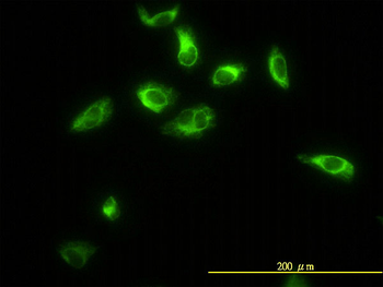 TPMT monoclonal antibody (M01), clone 1B5