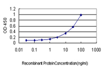 TOP2A monoclonal antibody (M01), clone 1E2