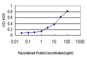 TOP1 monoclonal antibody (M01), clone 1A1
