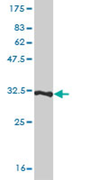 TMSB4X monoclonal antibody (M03), clone 4H7