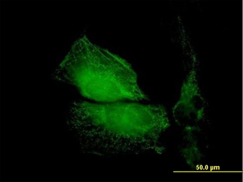TMOD1 purified MaxPab mouse polyclonal antibody (B01P)