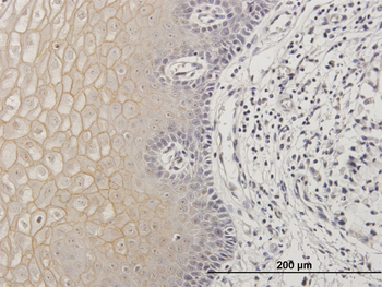 TGM1 purified MaxPab mouse polyclonal antibody (B02P)