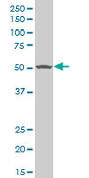 TGFBR1 polyclonal antibody (A01)